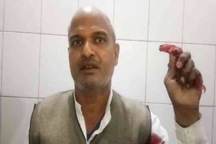 murder attempt in Ghazipur