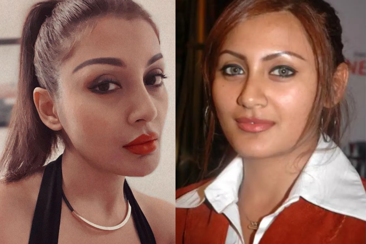 Rimi Sen plastic surgery